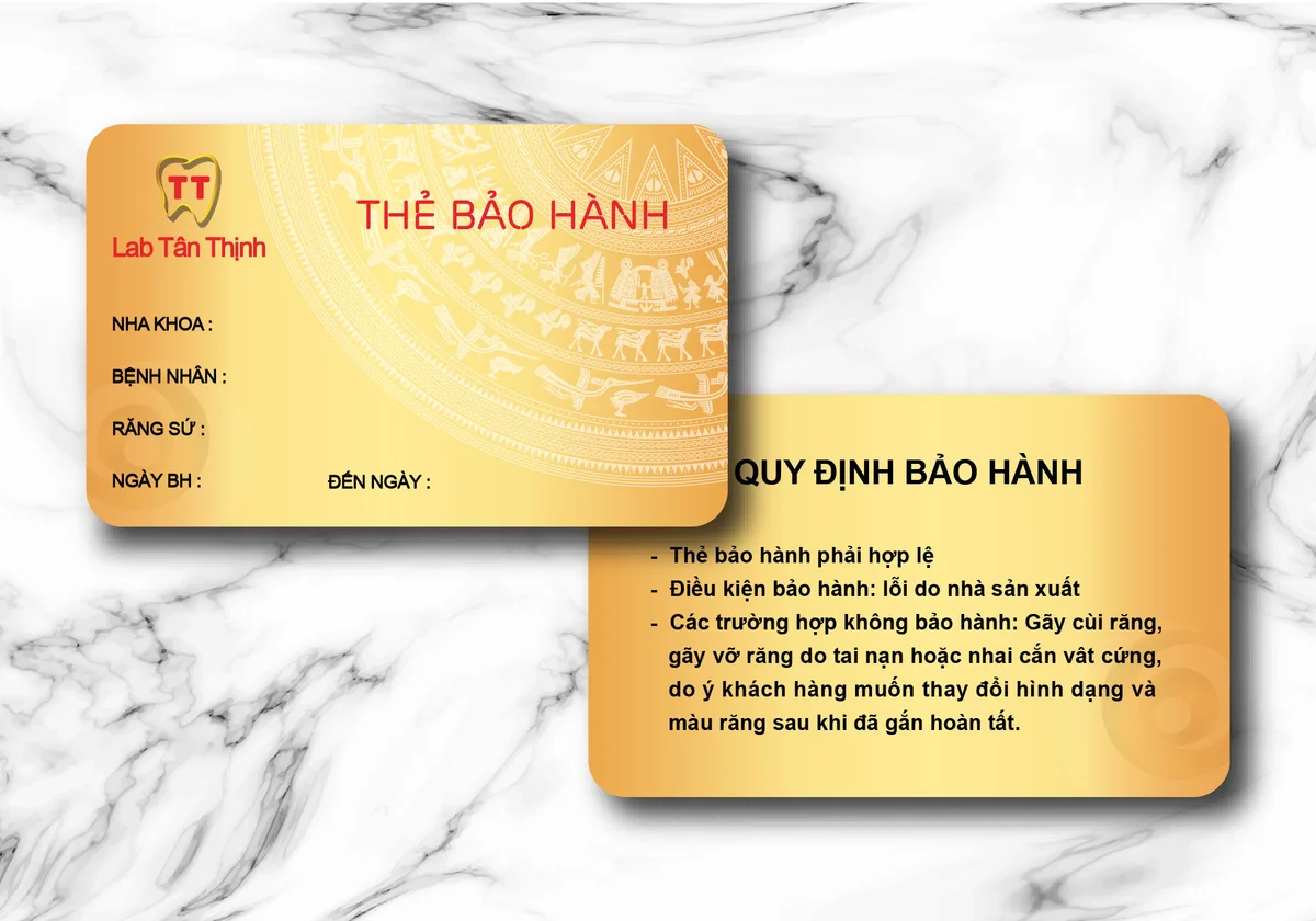 Bỏ túi địa chỉ in thẻ nhựa theo yêu cầu uy tín, chất lượng 